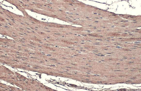 TAGLN Antibody in Immunohistochemistry (Paraffin) (IHC (P))