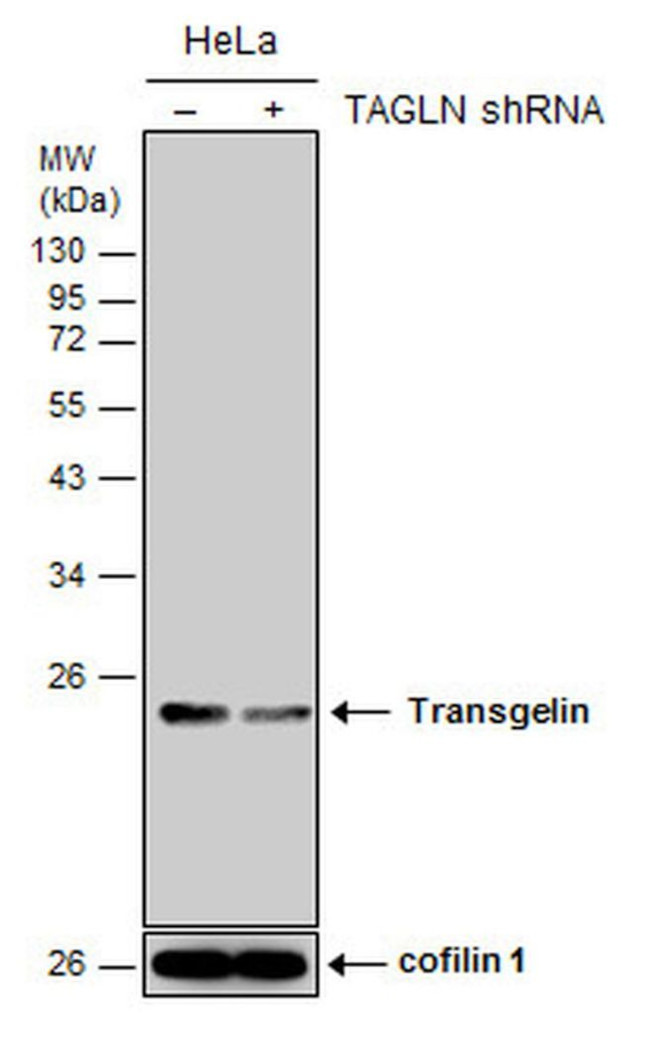 TAGLN Antibody