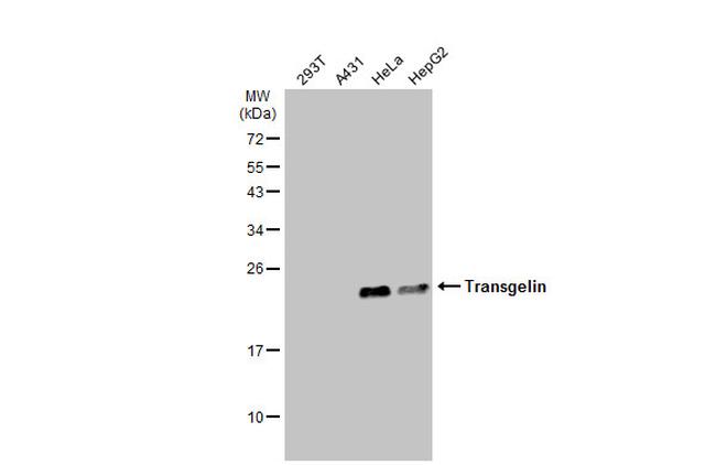 TAGLN Antibody in Western Blot (WB)