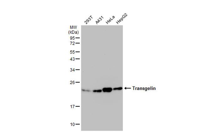 TAGLN Antibody in Western Blot (WB)