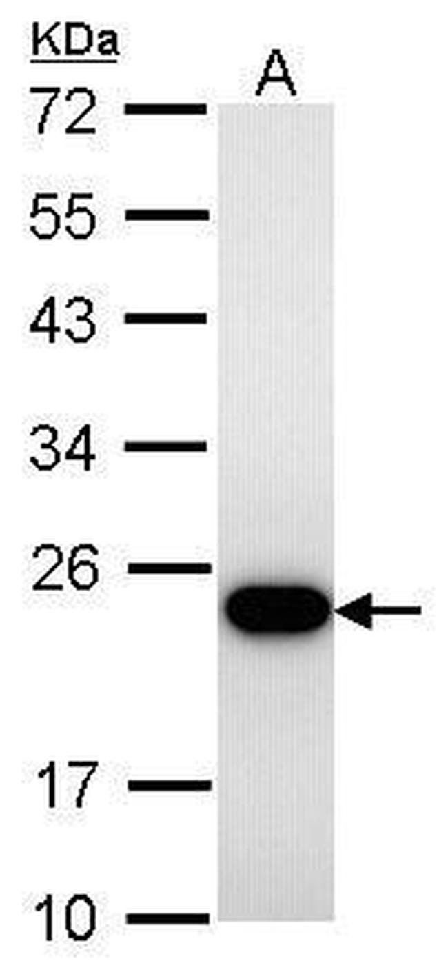 TAGLN Antibody in Western Blot (WB)