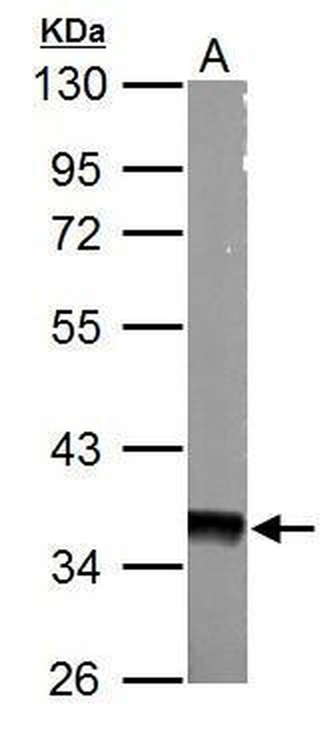 AMPK gamma-1 Antibody in Western Blot (WB)