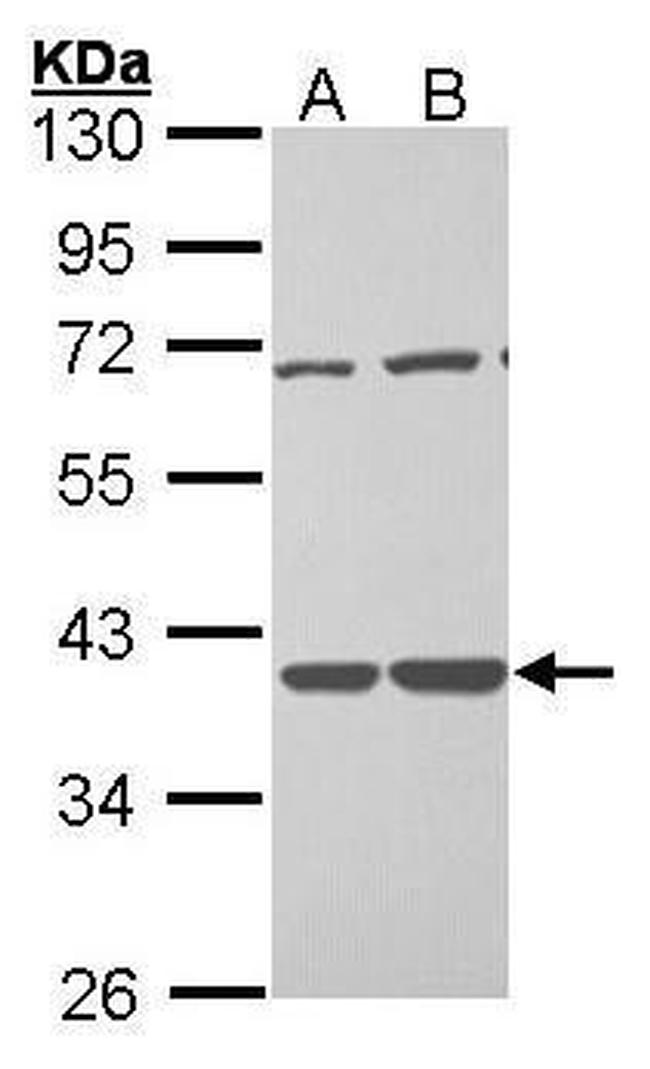 TSTA3 Antibody in Western Blot (WB)