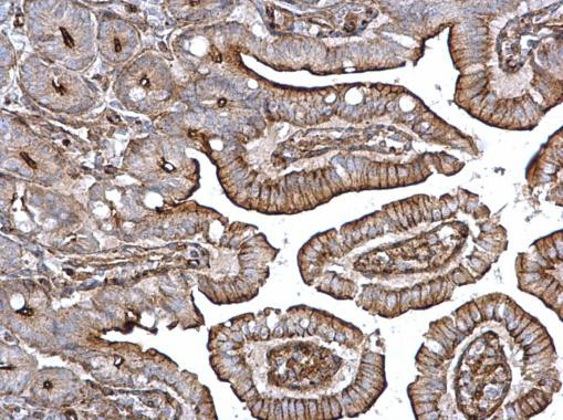 alpha Actinin 4 Antibody in Immunohistochemistry (Paraffin) (IHC (P))