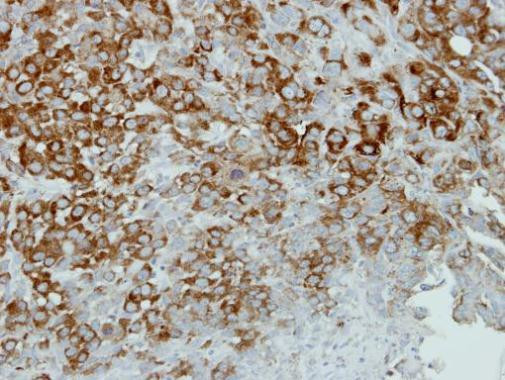 alpha Actinin 4 Antibody in Immunohistochemistry (Paraffin) (IHC (P))