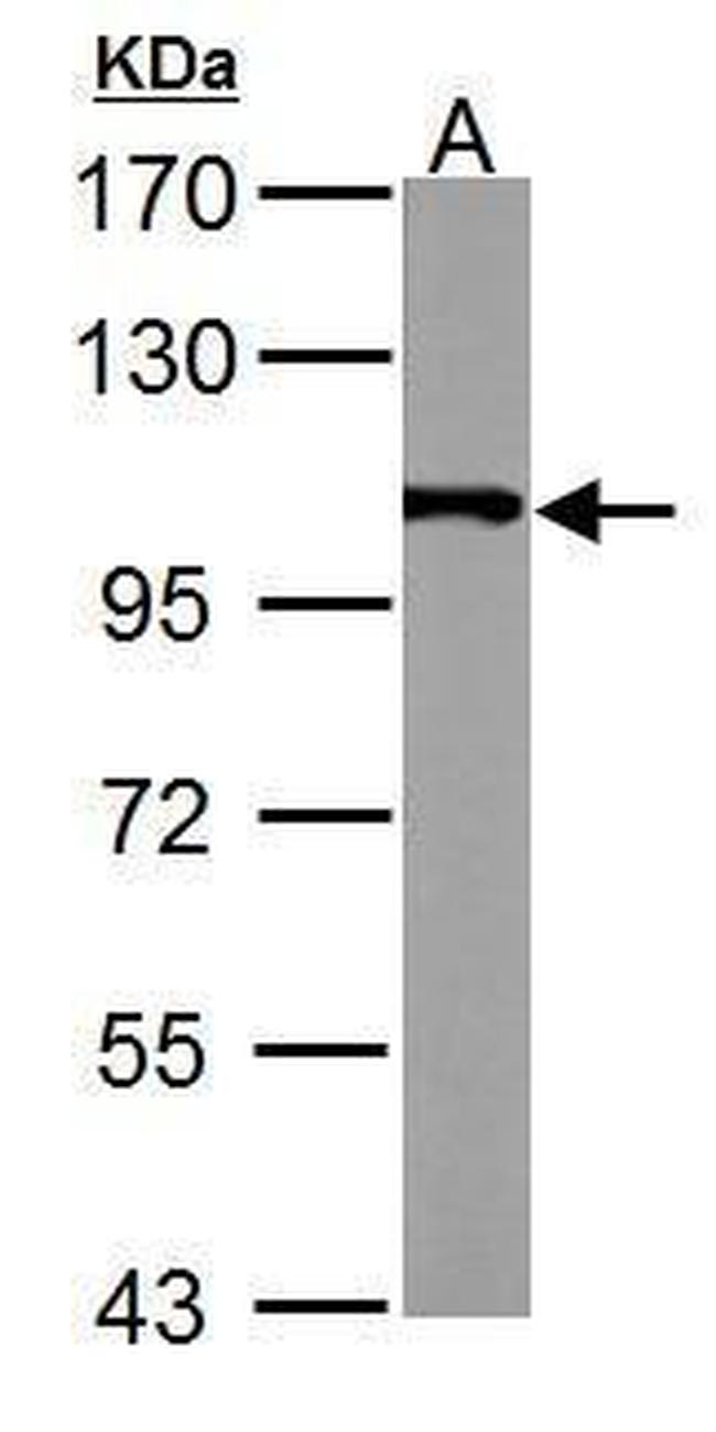 alpha Actinin 4 Antibody in Western Blot (WB)