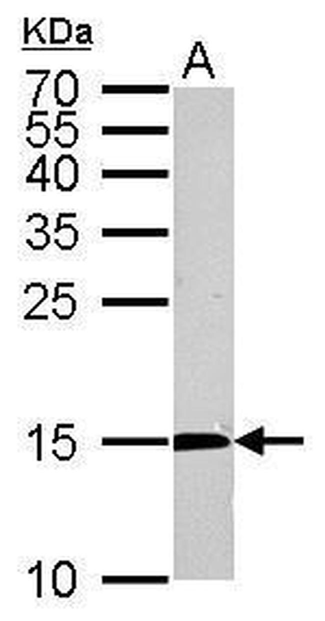 CDA Antibody in Western Blot (WB)