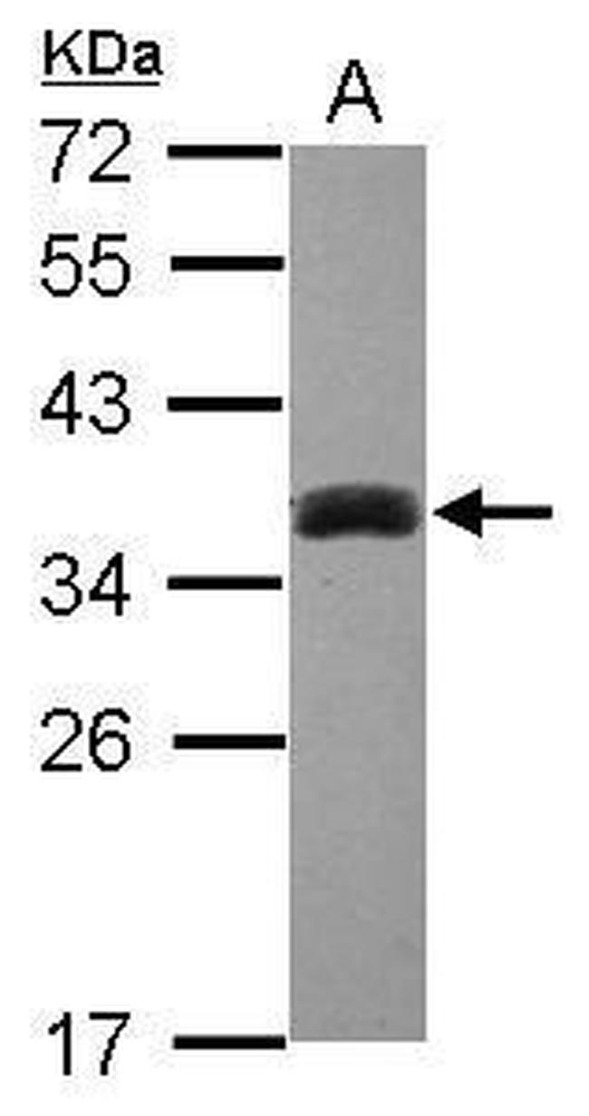 SULT1A3 Antibody in Western Blot (WB)