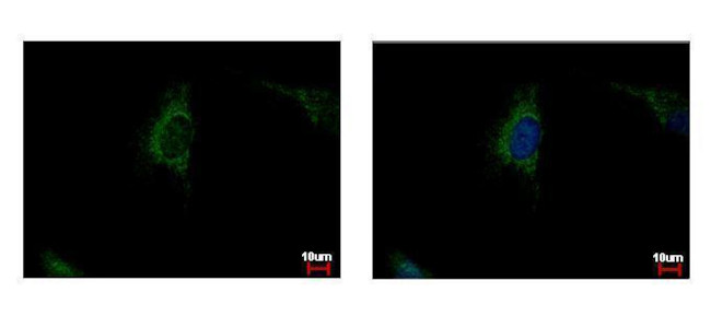 SDHA Antibody in Immunocytochemistry (ICC/IF)