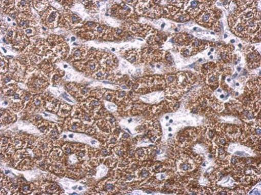 SDHA Antibody in Immunohistochemistry (Paraffin) (IHC (P))