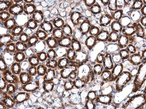 ILK Antibody in Immunohistochemistry (Paraffin) (IHC (P))