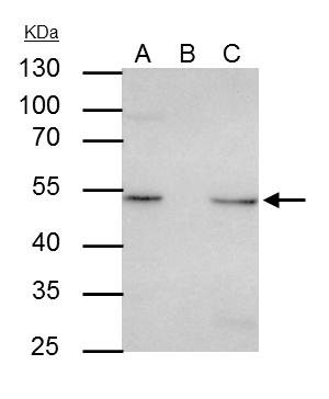 ILK Antibody in Immunoprecipitation (IP)