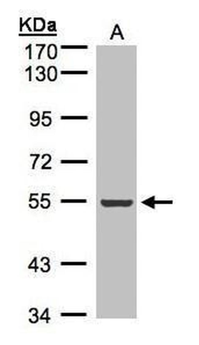 ILK Antibody in Western Blot (WB)