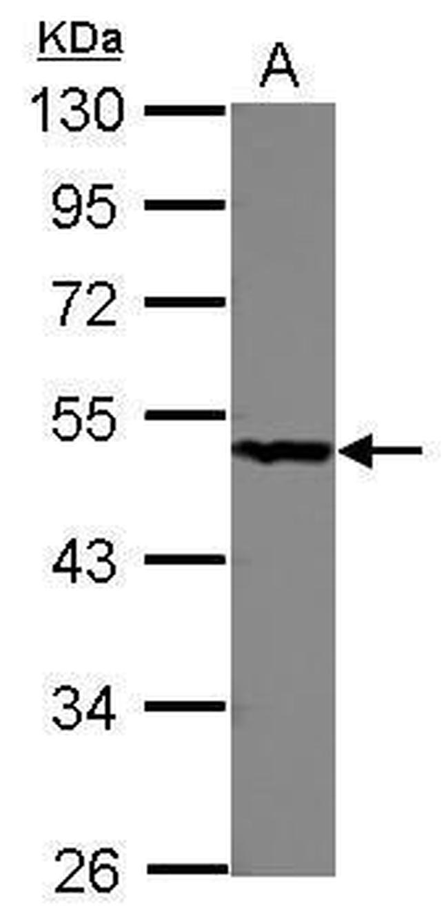 PGD Antibody in Western Blot (WB)