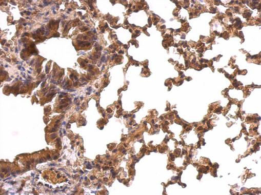 PRDX1 Antibody in Immunohistochemistry (Paraffin) (IHC (P))