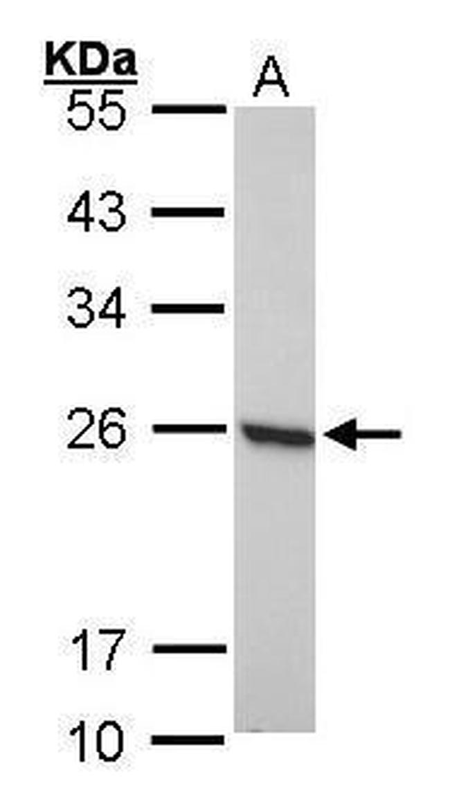 PRDX1 Antibody in Western Blot (WB)