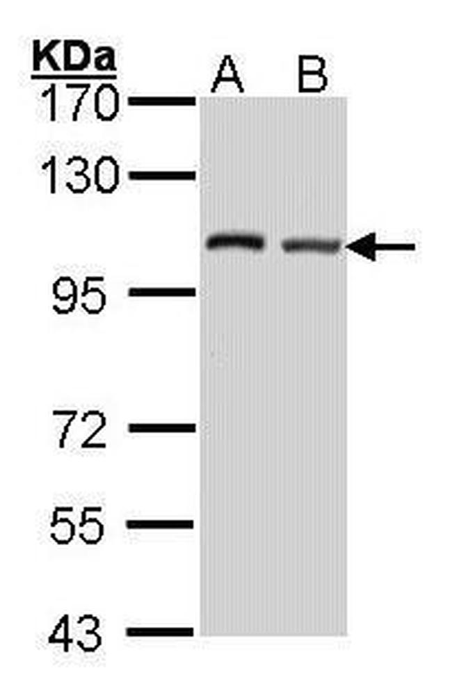 DAP5 Antibody in Western Blot (WB)