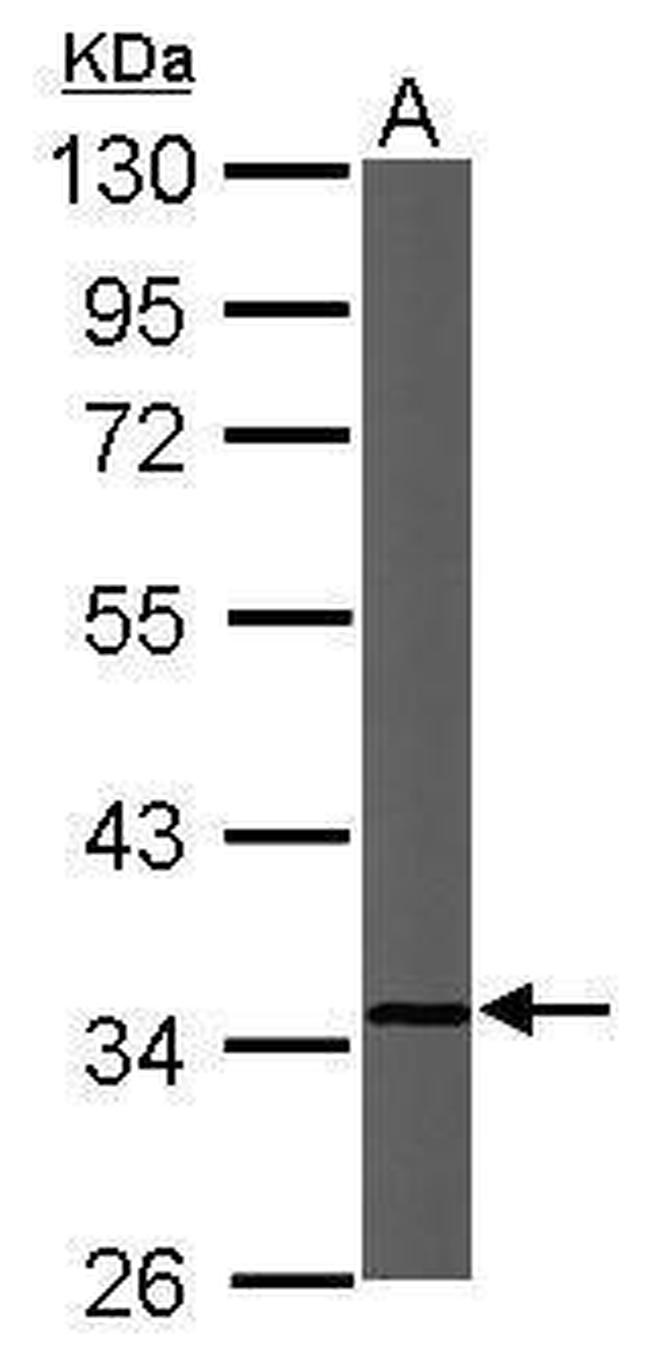 Cytochrome C1 Antibody in Western Blot (WB)