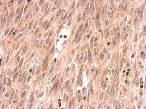 SOS2 Antibody in Immunohistochemistry (Paraffin) (IHC (P))