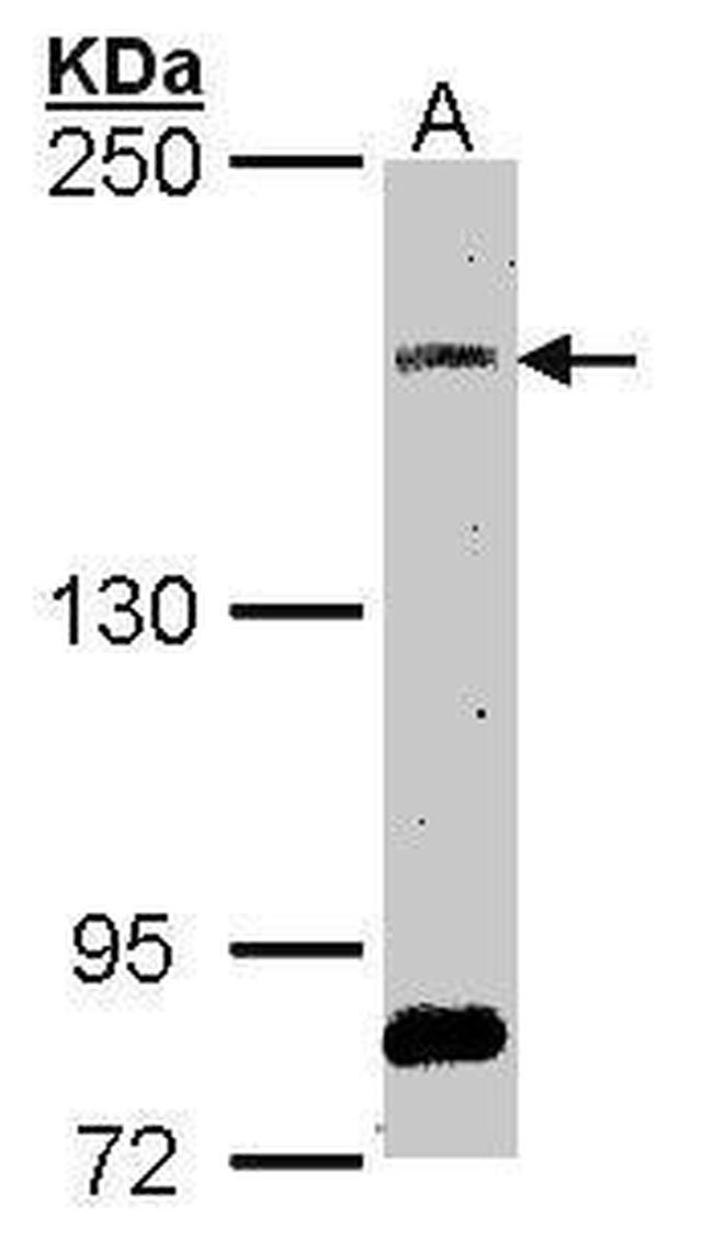 SOS2 Antibody in Western Blot (WB)