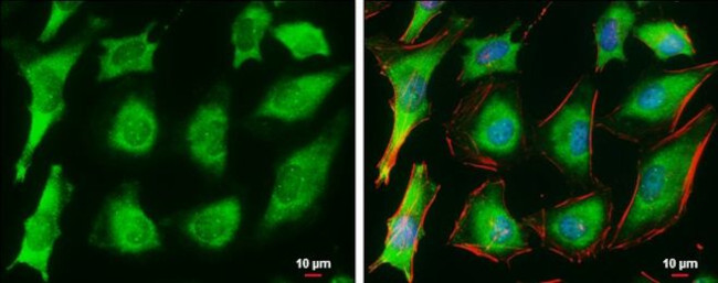 Ferritin Heavy Chain Antibody in Immunocytochemistry (ICC/IF)