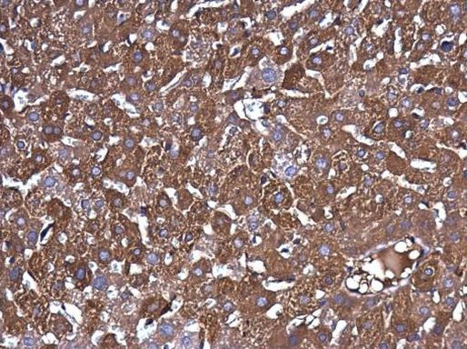 Ferritin Heavy Chain Antibody in Immunohistochemistry (Paraffin) (IHC (P))