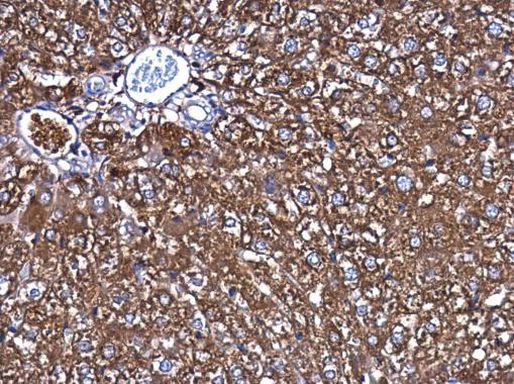 Ferritin Heavy Chain Antibody in Immunohistochemistry (Paraffin) (IHC (P))