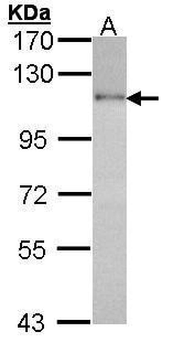 HGS Antibody in Western Blot (WB)
