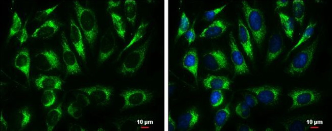 ATP5A1 Antibody in Immunocytochemistry (ICC/IF)