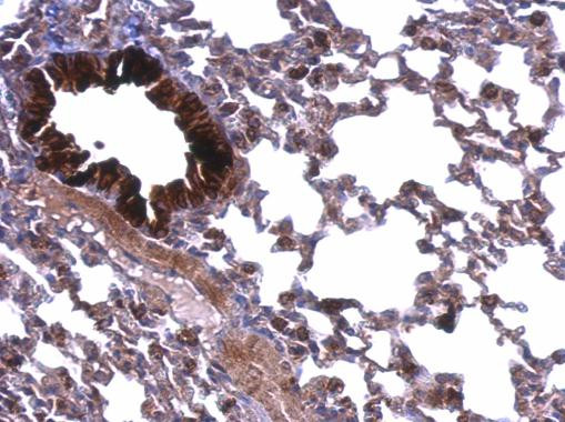 ATP5A1 Antibody in Immunohistochemistry (Paraffin) (IHC (P))