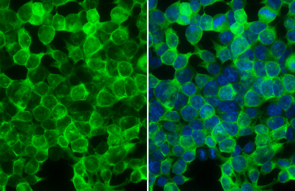 Creatine Kinase BB Antibody in Immunocytochemistry (ICC/IF)