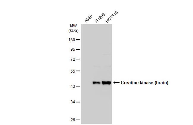 Creatine Kinase BB Antibody in Western Blot (WB)