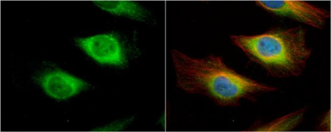 Creatine Kinase BB Antibody in Immunocytochemistry (ICC/IF)