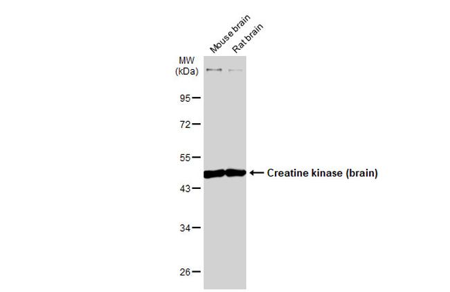 Creatine Kinase BB Antibody in Western Blot (WB)