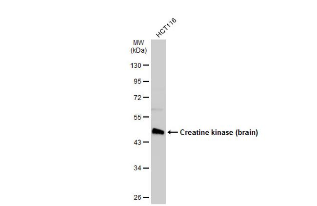 Creatine Kinase BB Antibody in Western Blot (WB)