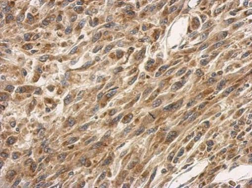 SLC25A11 Antibody in Immunohistochemistry (Paraffin) (IHC (P))