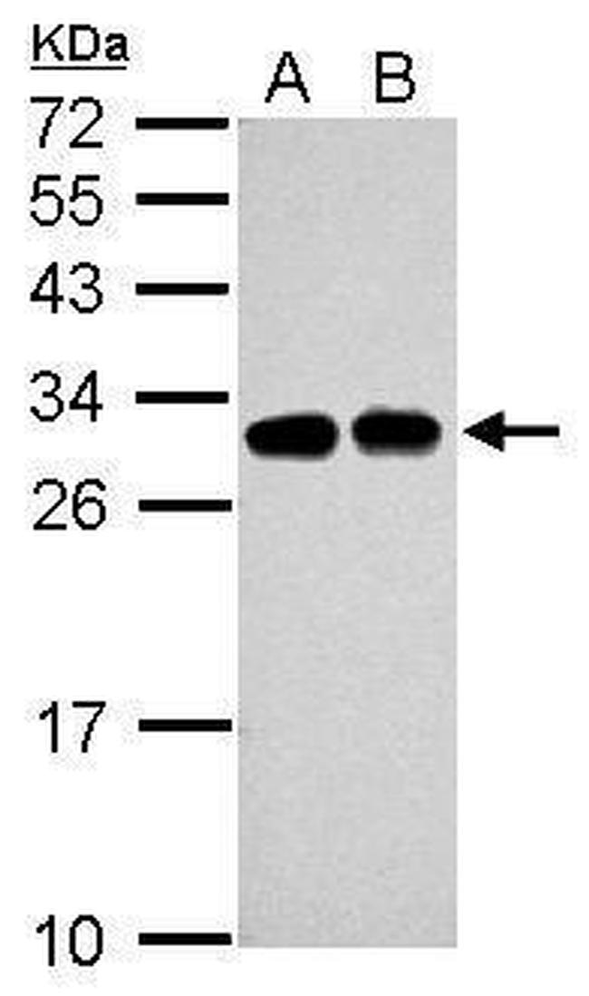 SLC25A11 Antibody in Western Blot (WB)