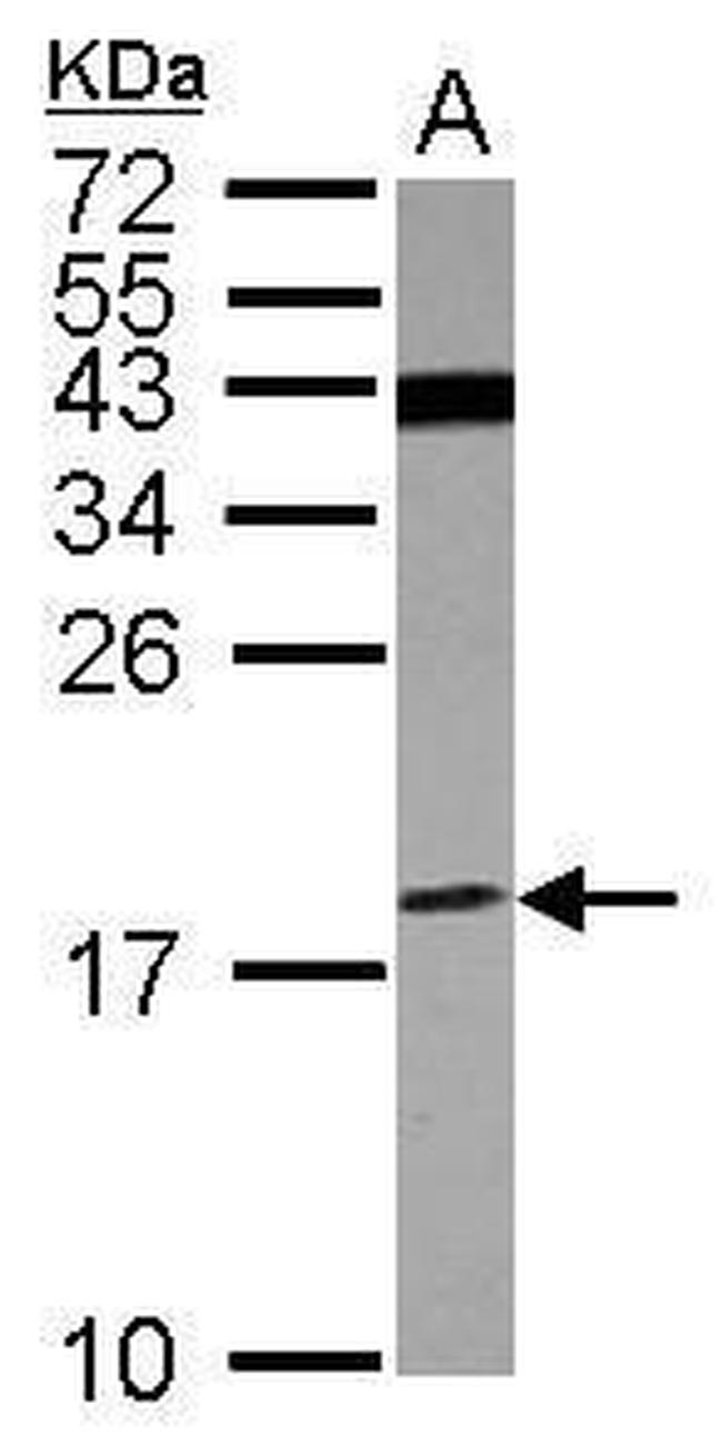 ATP6V1F Antibody in Western Blot (WB)