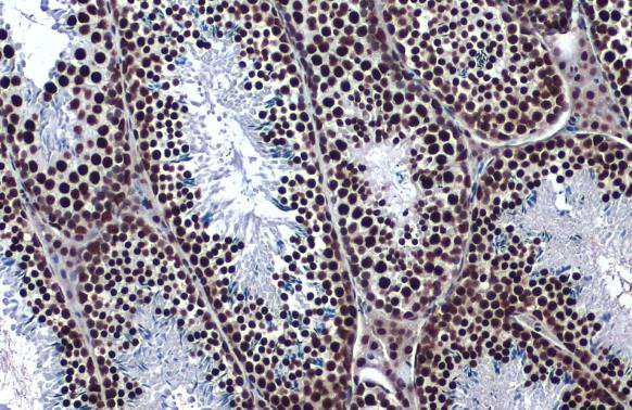 hnRNP K Antibody in Immunohistochemistry (Paraffin) (IHC (P))