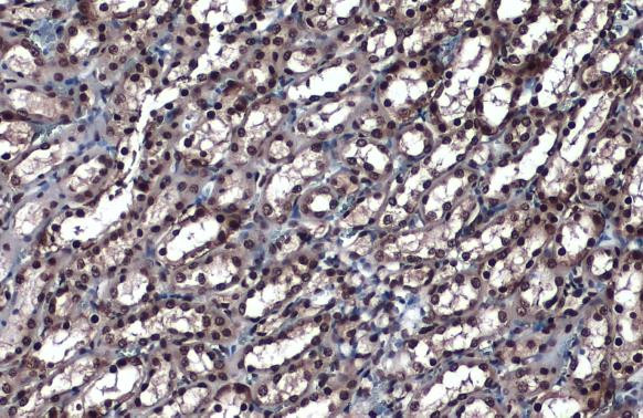 hnRNP K Antibody in Immunohistochemistry (Paraffin) (IHC (P))