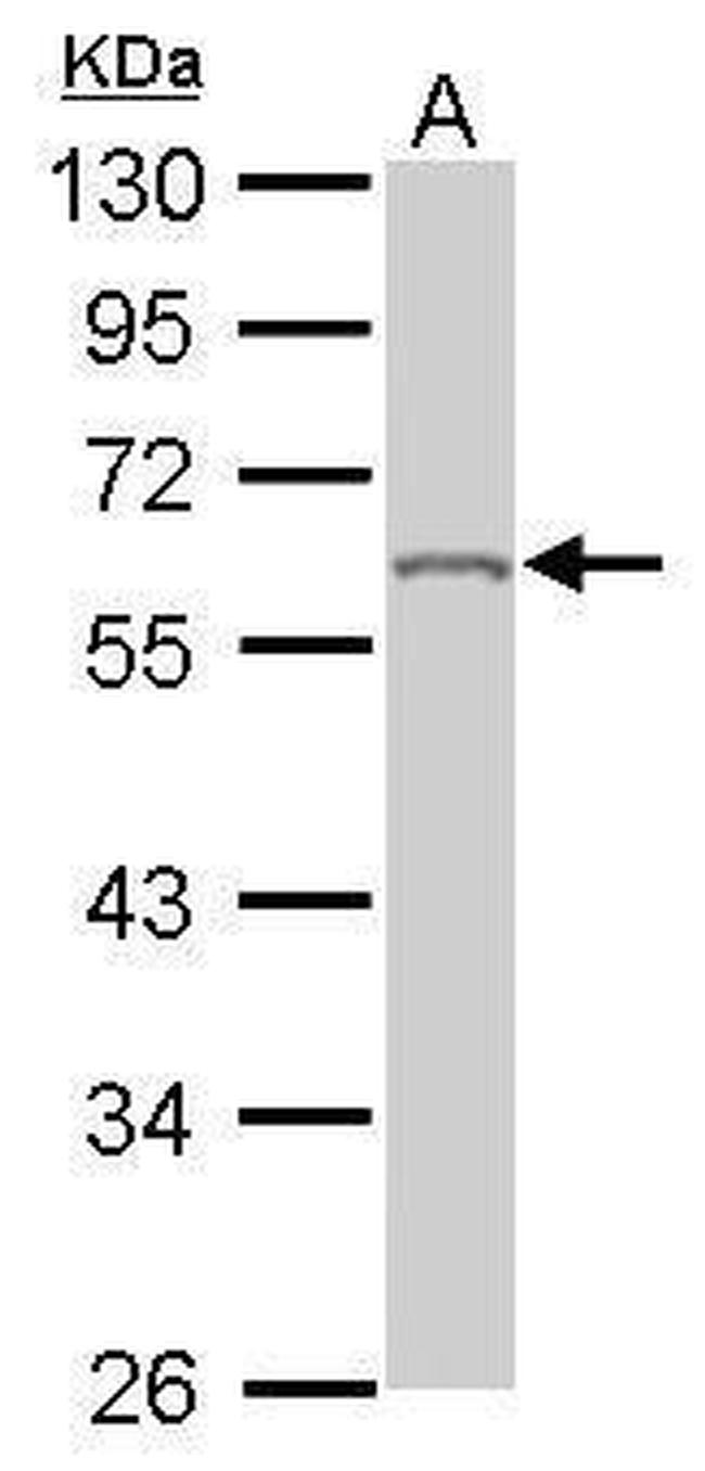 hnRNP K Antibody in Western Blot (WB)