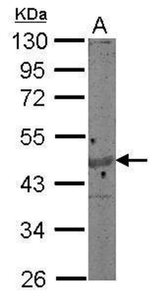 gamma Actin Antibody in Western Blot (WB)