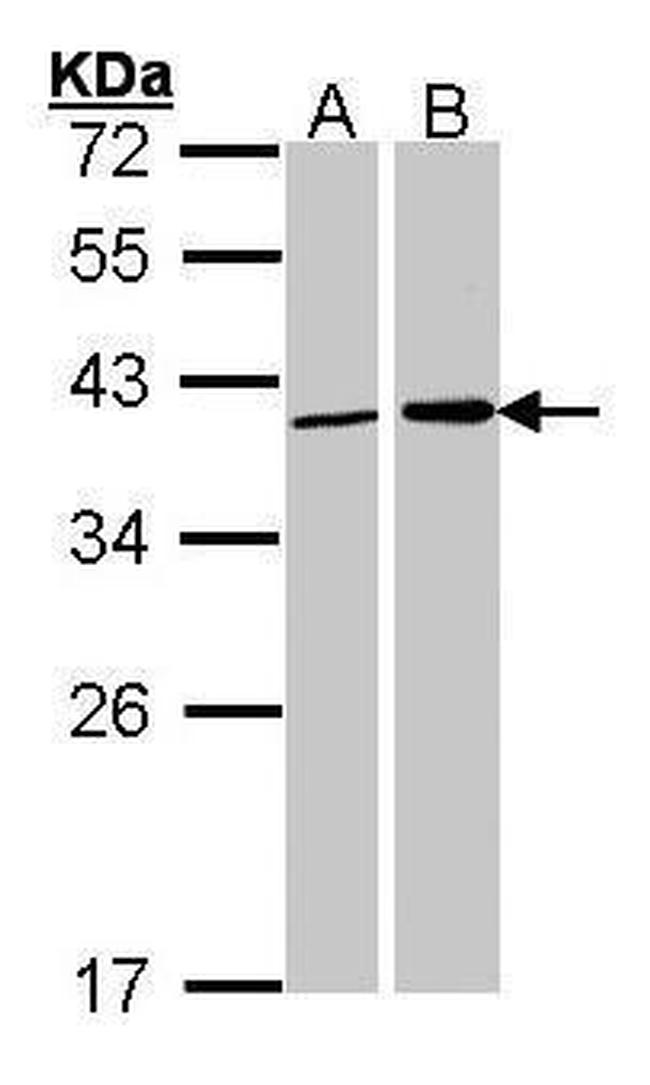 Fibrillarin Antibody in Western Blot (WB)