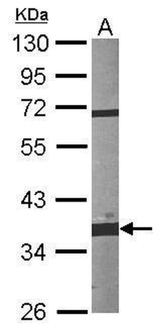 Fibrillarin Antibody in Western Blot (WB)