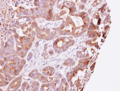 GUK1 Antibody in Immunohistochemistry (Paraffin) (IHC (P))