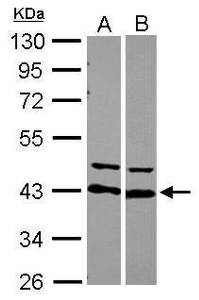 hnRNP D Antibody in Western Blot (WB)