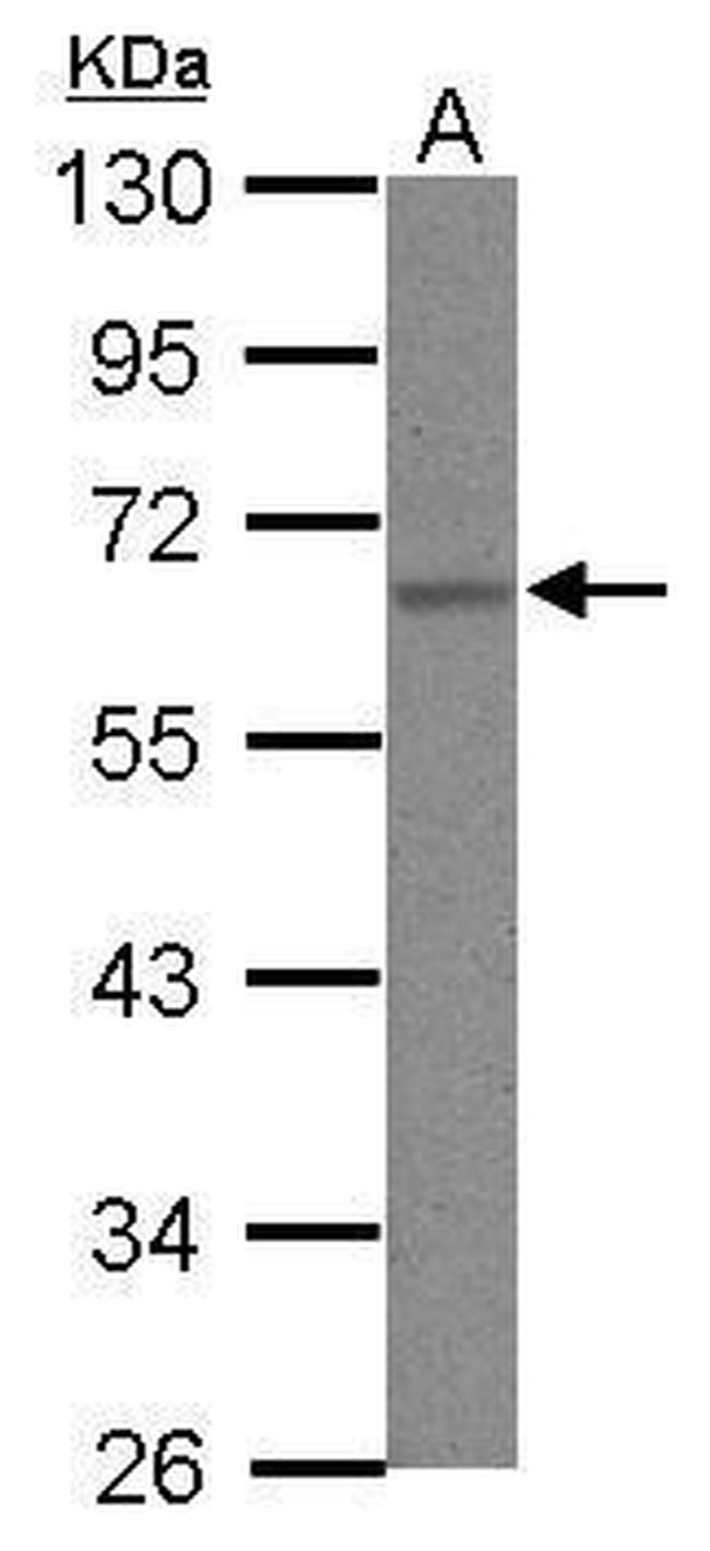 hnRNP K Antibody in Western Blot (WB)