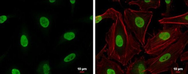 Ku70 Antibody in Immunocytochemistry (ICC/IF)