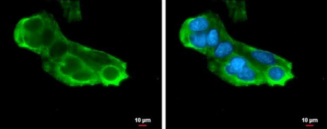 RPL5 Antibody in Immunocytochemistry (ICC/IF)