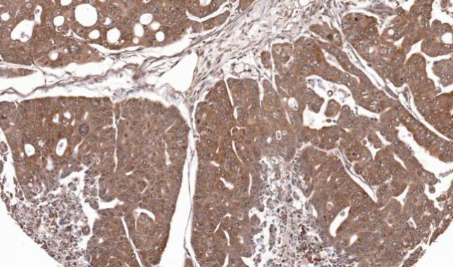 RPL5 Antibody in Immunohistochemistry (Paraffin) (IHC (P))